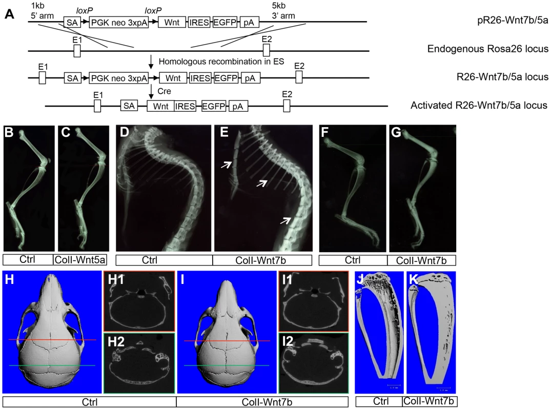 WNT7B, but not WNT5A, increases bone mass <i>in vivo</i>.
