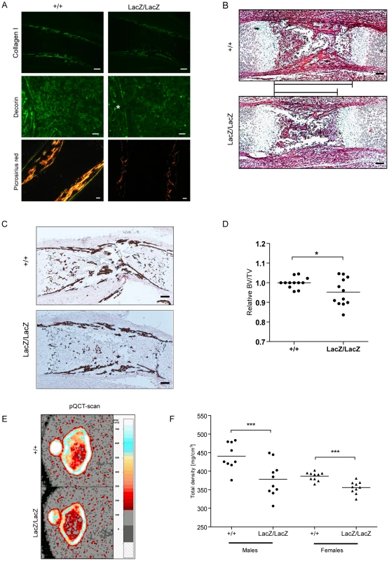 Prdm5 loss results in decreased Collagen I and Decorin levels and leads to reduced bone formation <i>in vivo</i>.