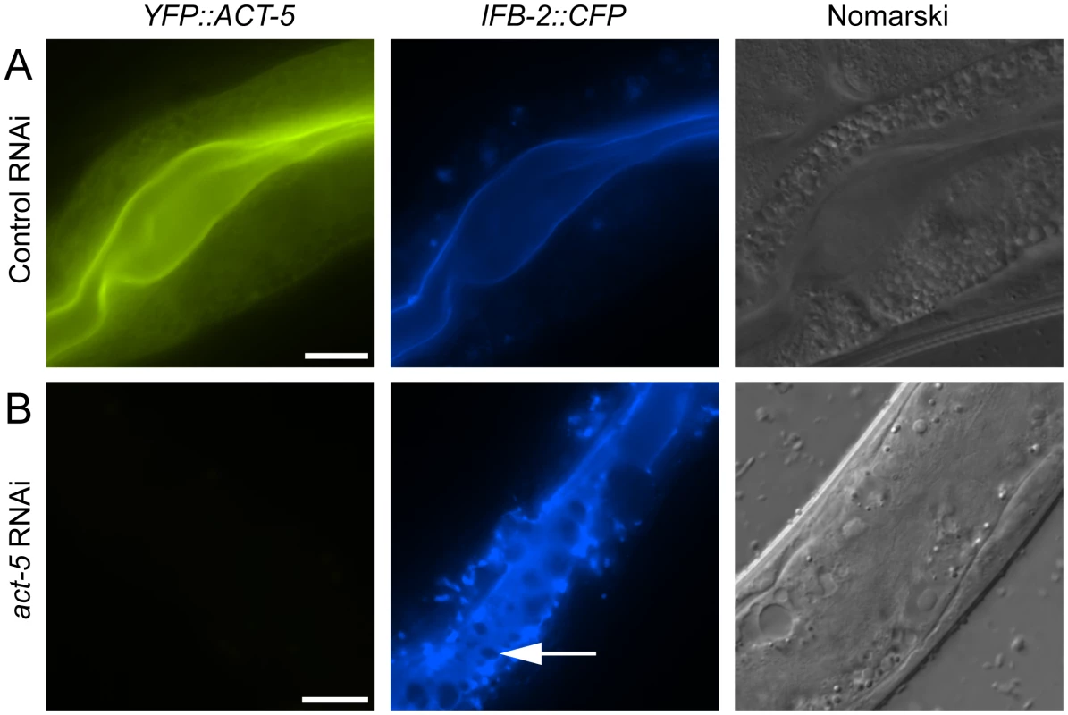 Reducing expression of actin causes terminal web gaps in the absence of infection.