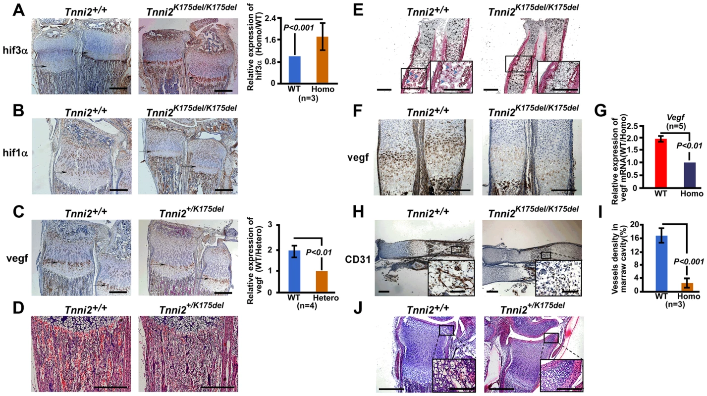 The disturbed <i>Hif</i> associated signaling in <i>Tnni2<sup>K175del</sup></i> mice resulted in reduced angiogenesis and impeded formation of ossification centers of long bones.