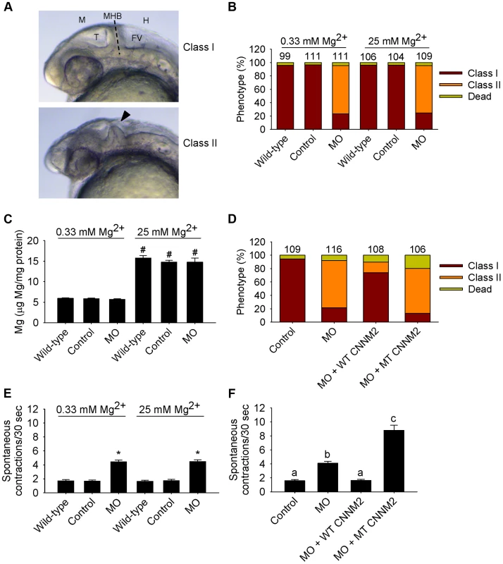 Dysfunctional c<i>nnm2a</i> causes brain abnormalities and increased spontaneous contractions in zebrafish embryos (25 hpf).