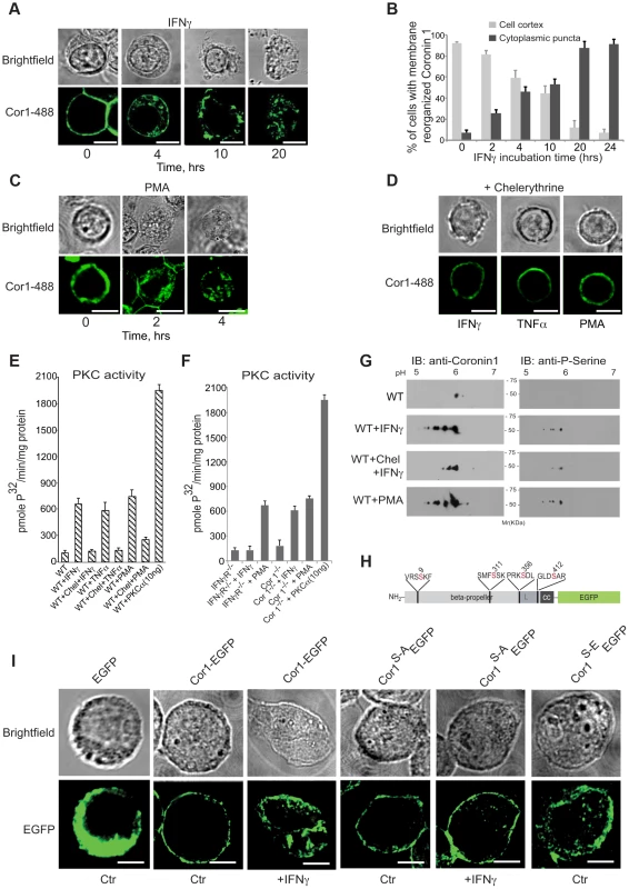 Coronin 1 relocalization and phosphorylation upon macrophage activation.