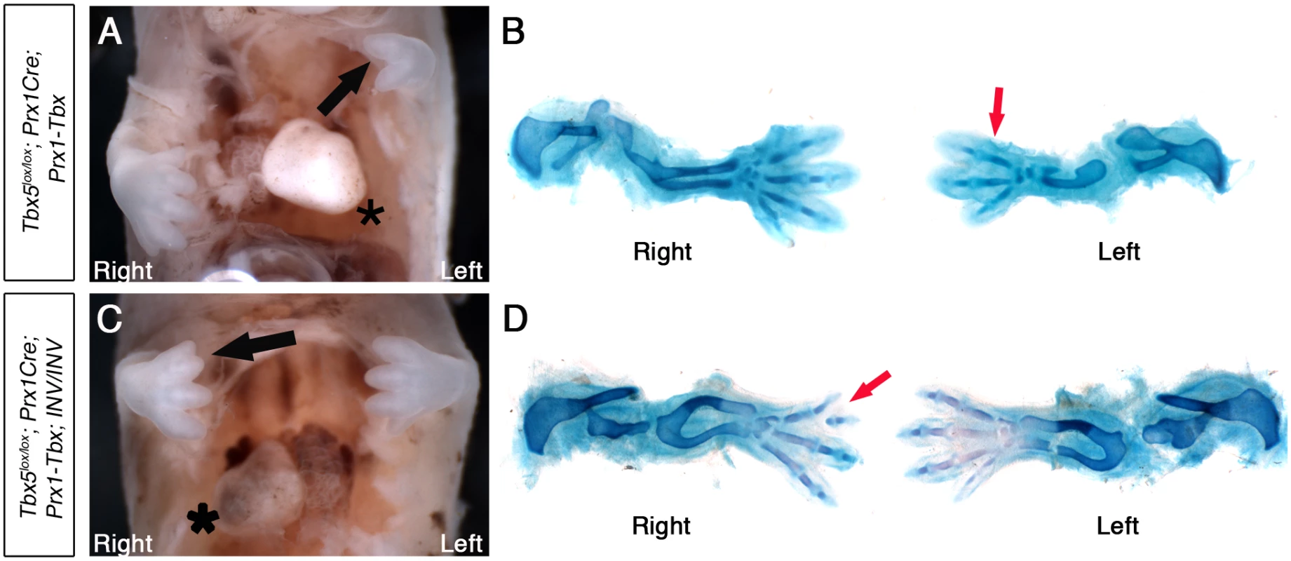<i>Tbx5</i><sup><i>lox/lox</i></sup><i>;Prx1Cre;Prx1-Tbx;INV/INV</i> mutants with <i>situs inversus</i> have right biased asymmetric forelimb defects.
