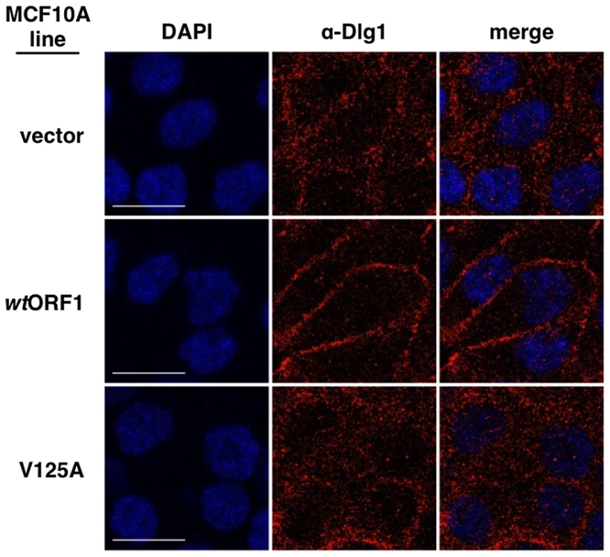 E4-ORF1 promotes translocation of cytoplasmic Dlg1 to the plasma membrane.