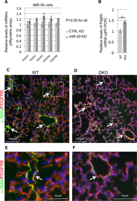 Upregulation of components of PDGF pathway in both miR-29 knockdown cells and miR-29 null lungs.