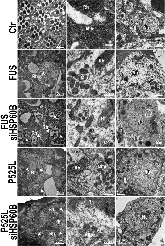Down-regulating HSP60B in fly photoreceptors partially rescues the retinal degeneration phenotype of FUS transgenic mice as shown by transmission electron microscopy (TEM).