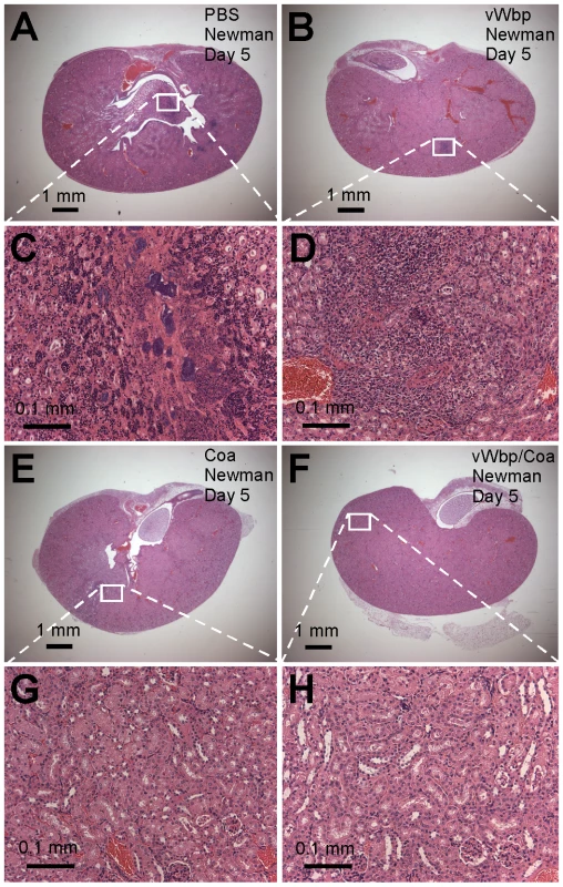 Immunization with coagulases protects mice against <i>S. aureus</i> abscess formation.