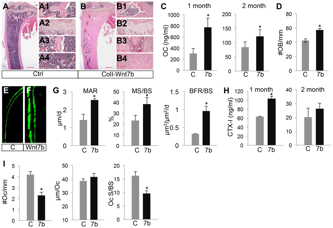 WNT7B increases osteoblast number and activity.