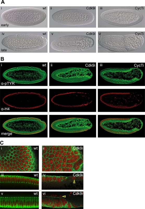 P-TEFb embryos show cellularization defects and lose cells in the embryo posterior.