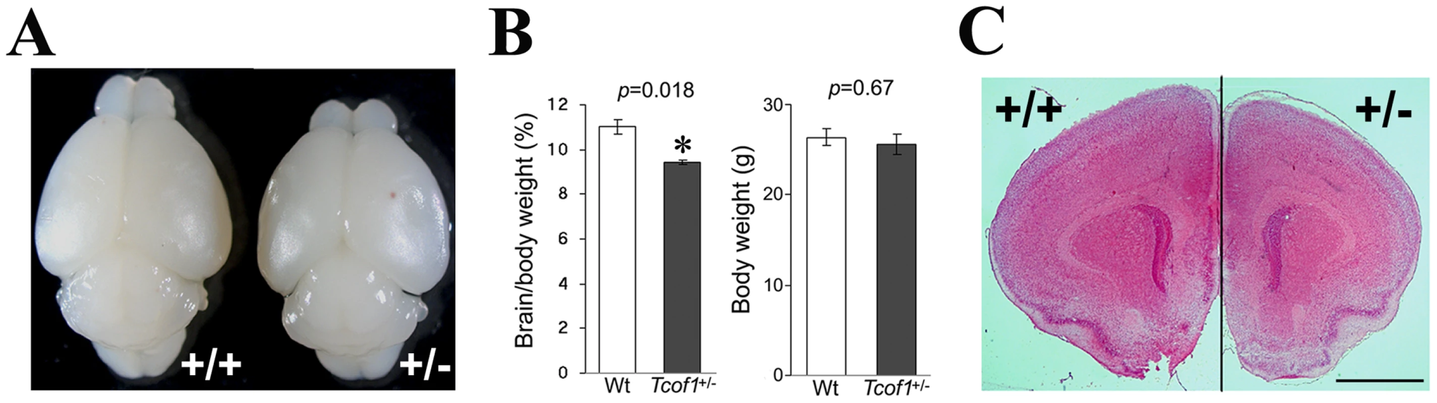 <i>Tcof1</i> heterozygous mutant mice show small brain.