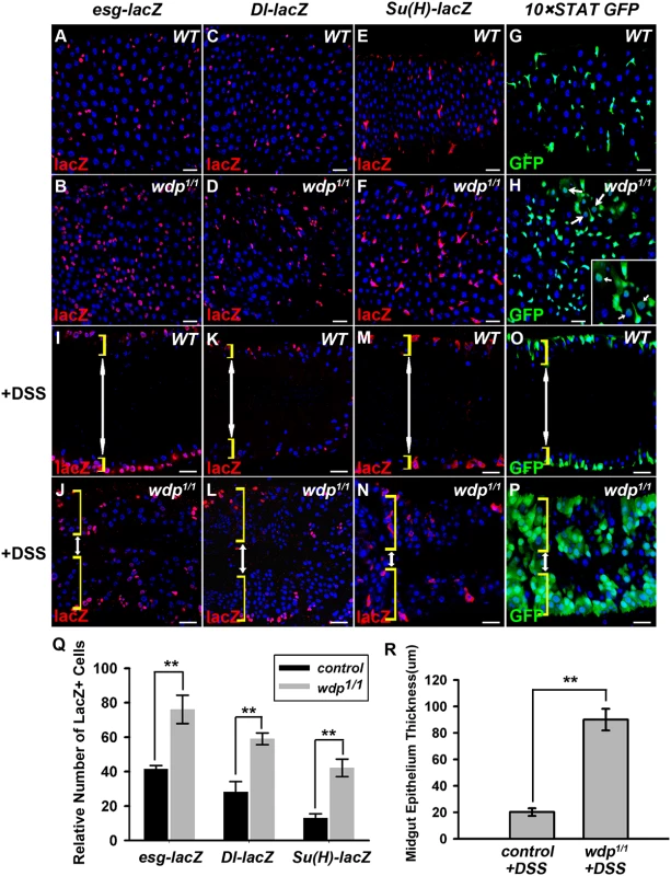 Loss of <i>wdp</i> disrupts midgut homeostasis under normal conditions and potentiates DSS-induced midgut regeneration.