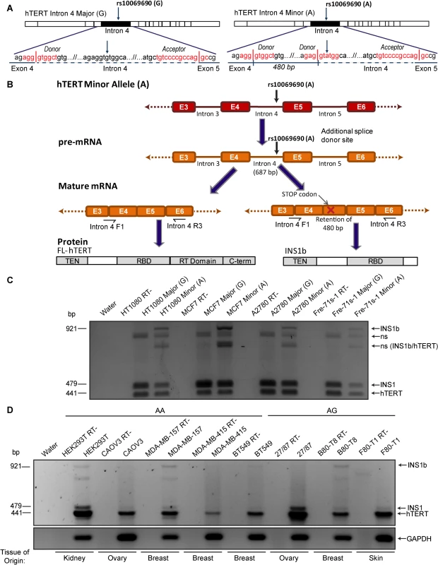 Cancer-associated rs10069690 minor allele results in alternative splicing of hTERT.