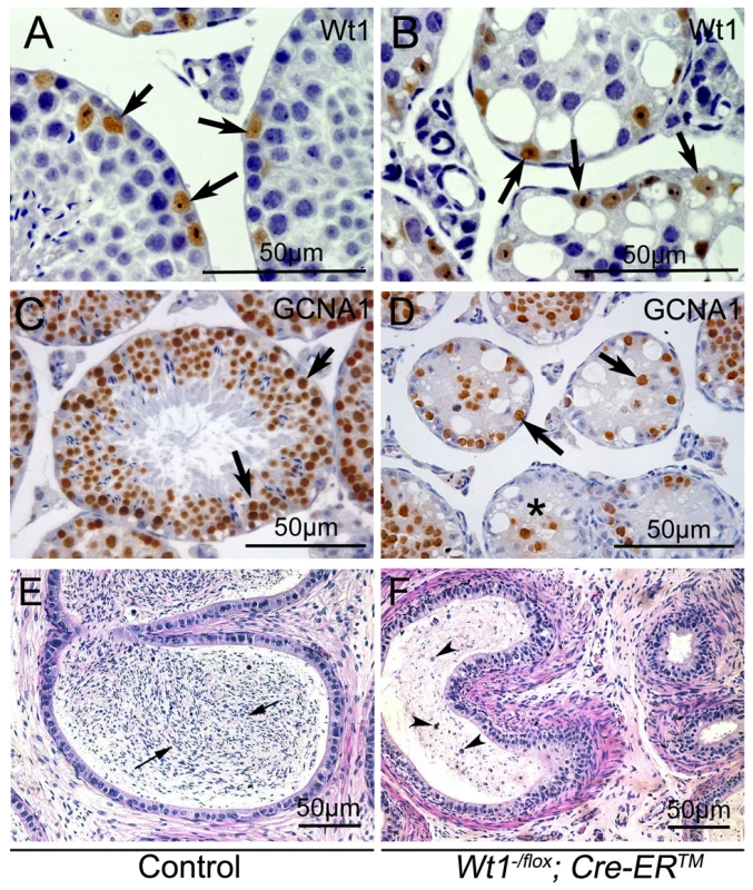 Loss of <i>Wt1</i> results in germ cell death: IHC and H &amp; E staining of testes 3 weeks after Tamoxifen treatment.