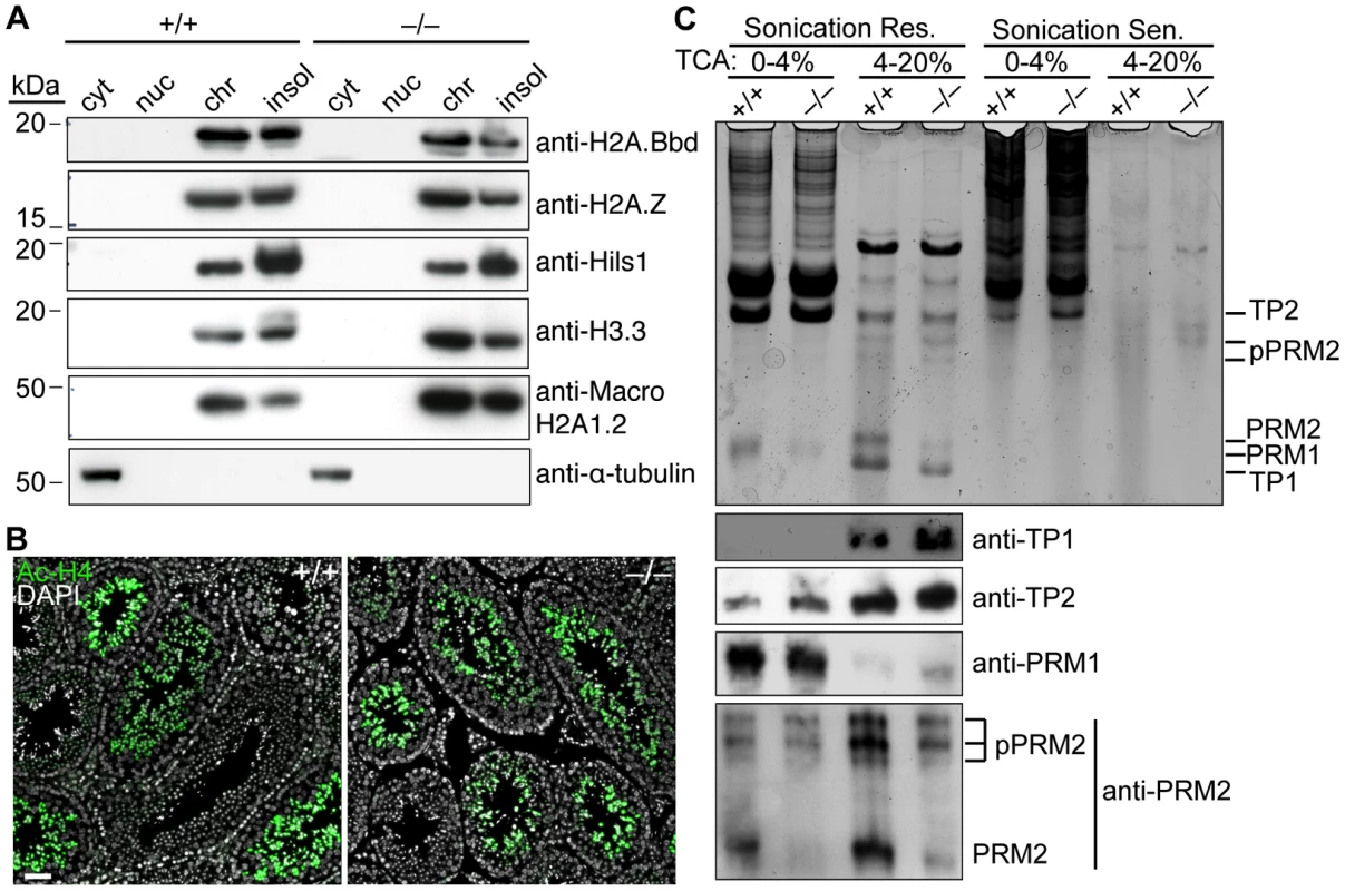 <i>Baz1a</i> is dispensable for spermatogenesis-associated changes in chromatin protein composition.