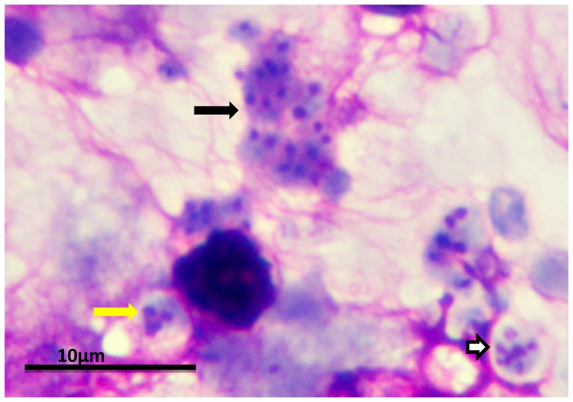 <i>P. murina</i> stained with rapid Wright-Giemsa.