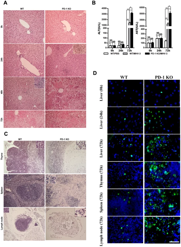 Multiple organ damage in PD-1-deficient mice after MHV-3 infection.