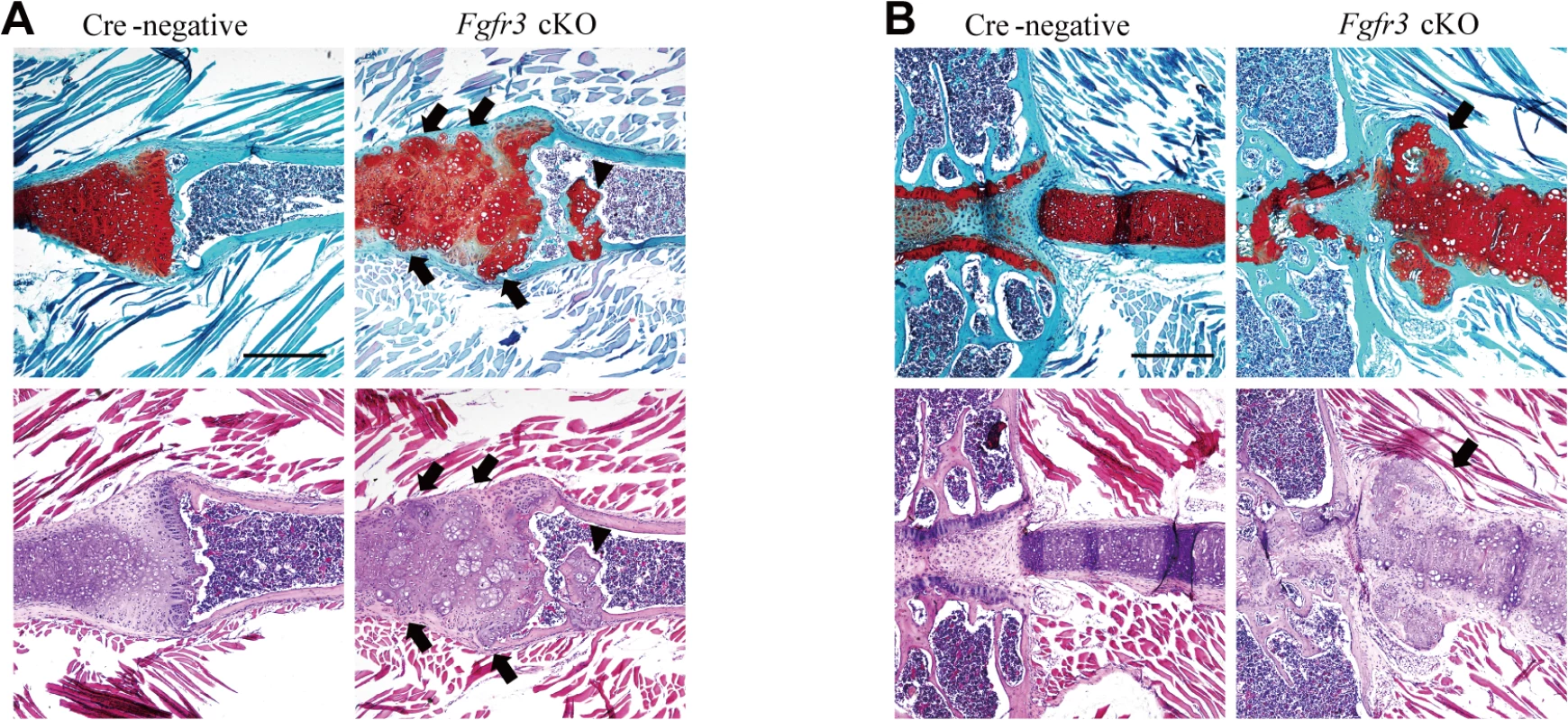 Histological assessment of the rib in <i>Fgfr3</i> cKO mice.