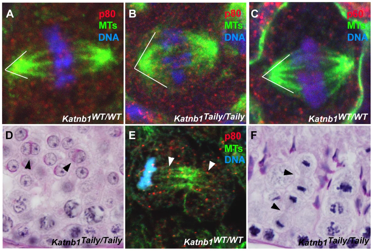 Defective meiotic division in <i>Katnb1<sup>Taily/Taily</sup></i> male gametes.