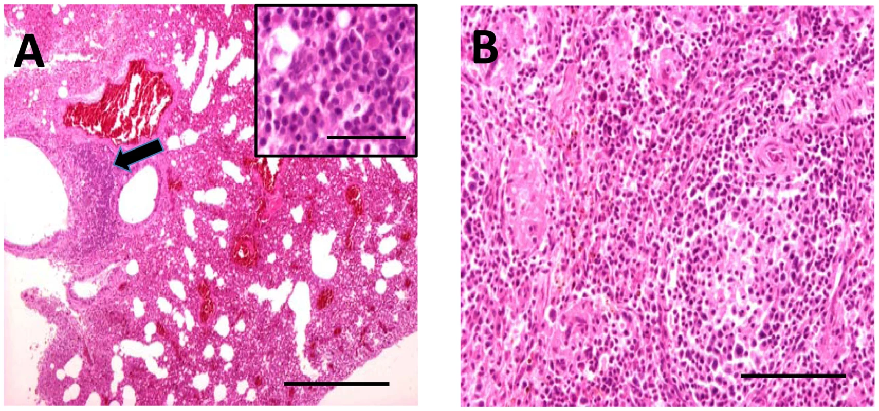 Hematoxylin and eosin stained sections through lung (A) and spleen (B) of infected <i>M. schreibersii</i>.