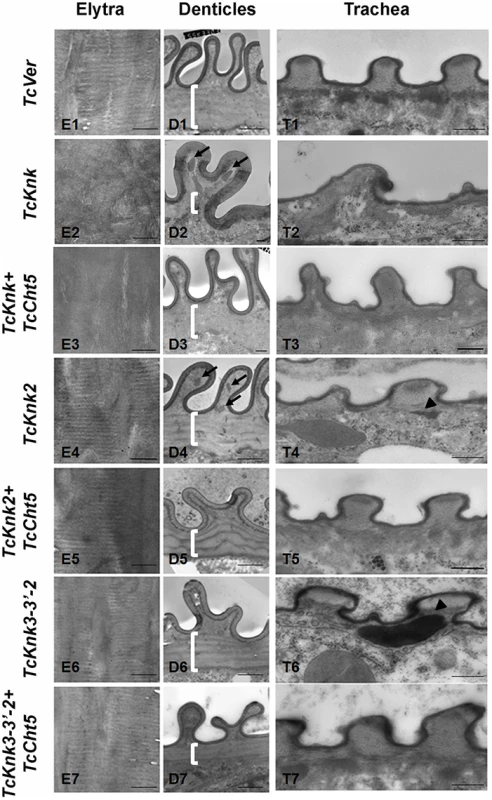 Transmission electron microscopic analysis of <i>TcKnk2</i> and <i>TcKnk3</i> (exon 9)-specific dsRNA-treated pharate adult elytra, lateral body wall denticles and tracheal taenidia.