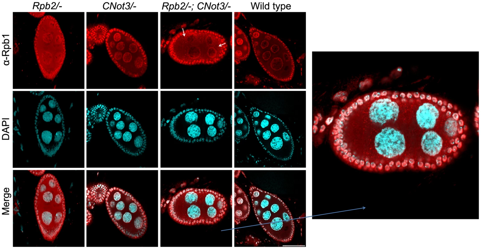 Rpb1 accumulates in cytoplasmic speckles in <i>RPB2</i>+/− <i>CNOT3</i>+/− trans- heterozygotes.