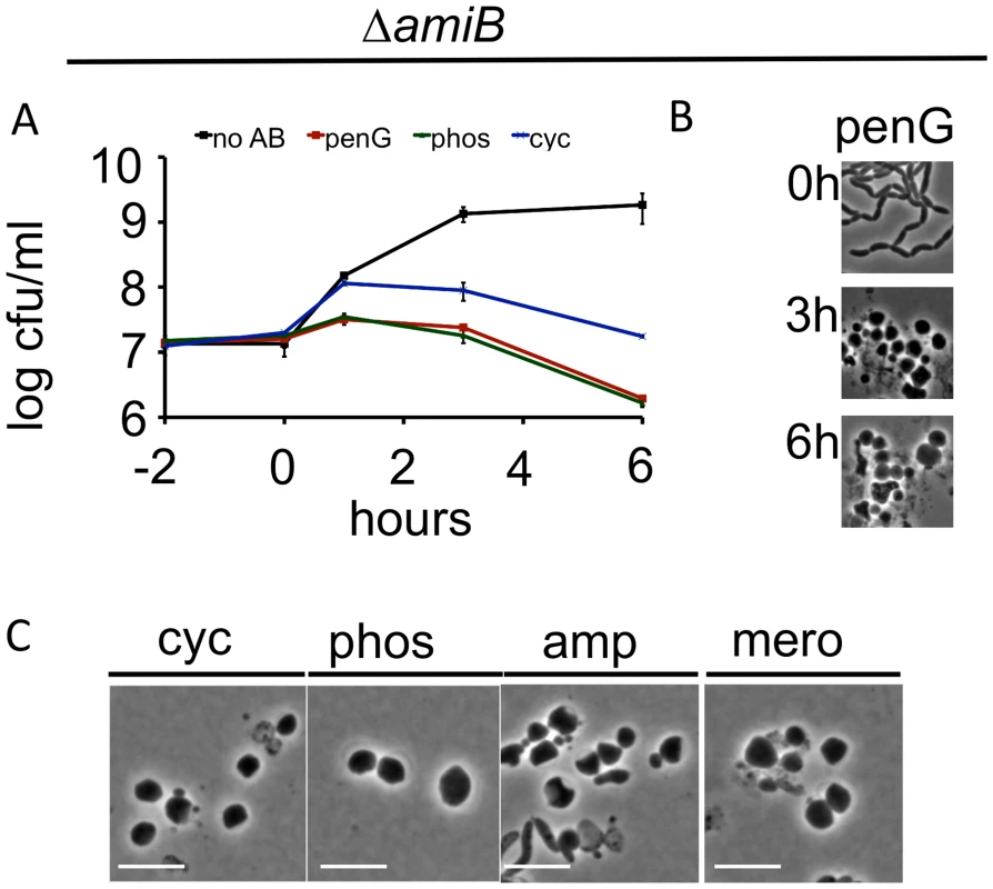 <i>V</i>. <i>cholerae amiB</i> is not required for sphere formation in response to inhibition of cell wall synthesis.