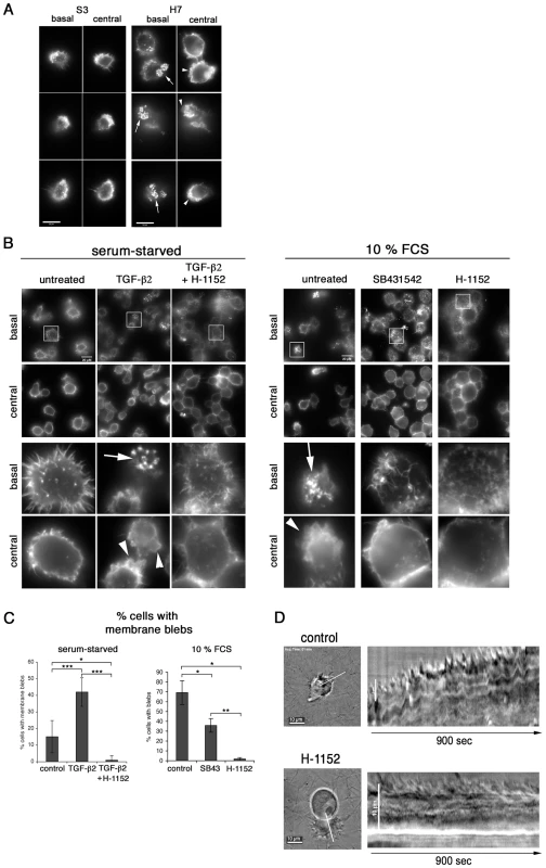 TGF-b promotes podosomal adhesion structures and ROCK-mediated cortical actin-rich membrane blebs.
