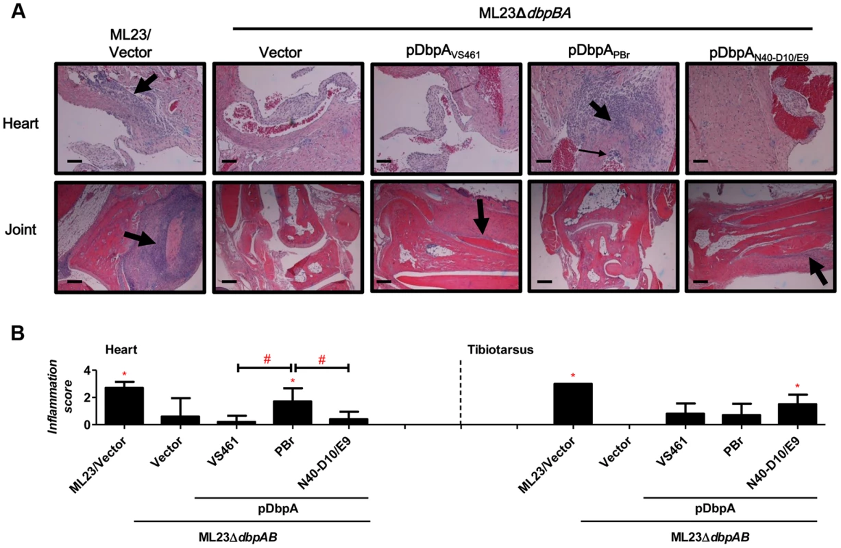 DbpA variants produced by <i>B. burgdorferi</i> lead to differences in tissue inflammation in C3H/HeN-infected mice.
