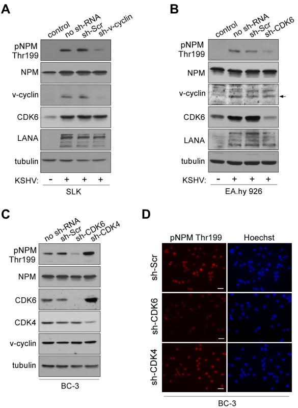 NPM phosphorylation is dependent on v-cyclin-CDK6 activity.