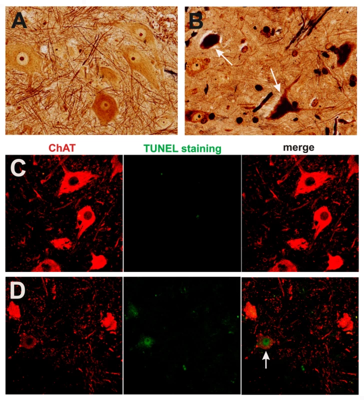 Degeneration of motor neurons in paralyzed mutant <i>TDP</i> transgenic rats.