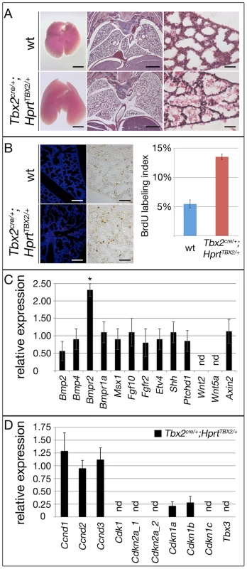 Prolonged expression of TBX2 maintains proliferation of mesenchymal progenitor cells in the embryonic lung.