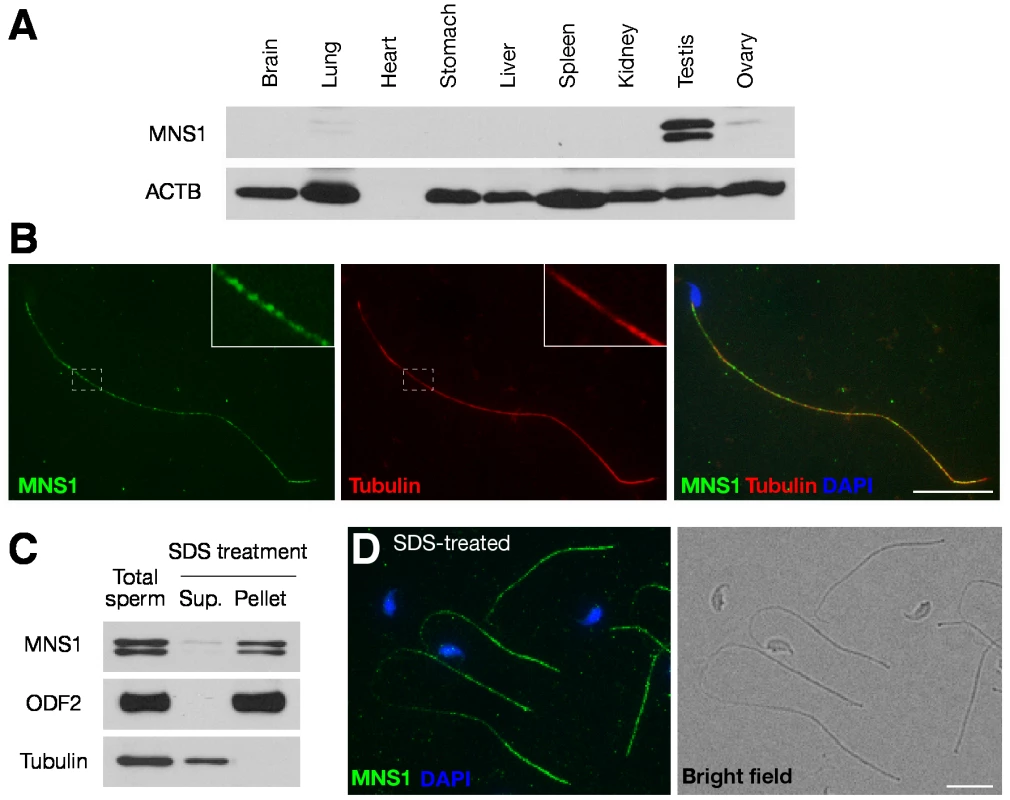 MNS1 is an integral component of sperm flagella.