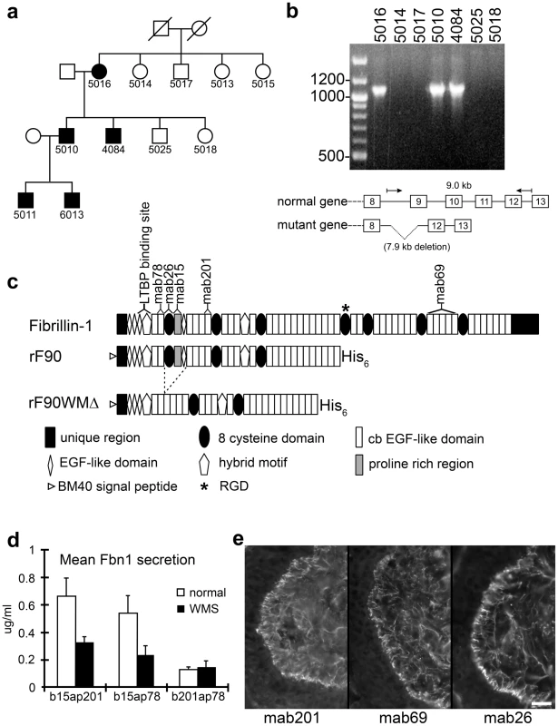 Characterization of a novel genomic deletion in <i>FBN1</i> in a family with WMS.
