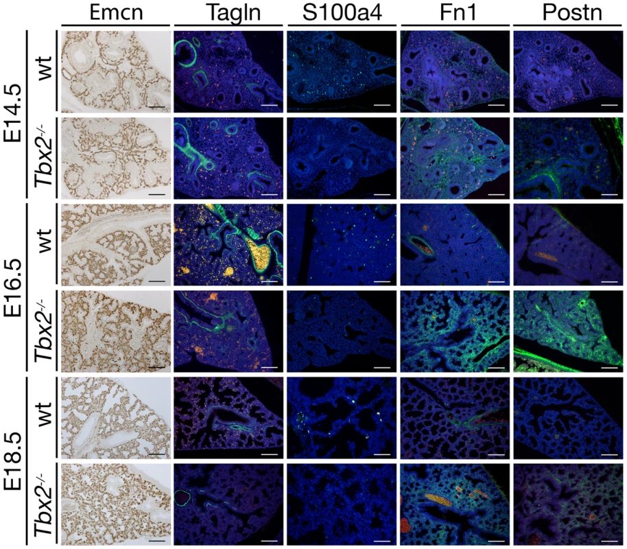 Precocious differentiation in the <i>Tbx2</i>-deficient lung mesenchyme.