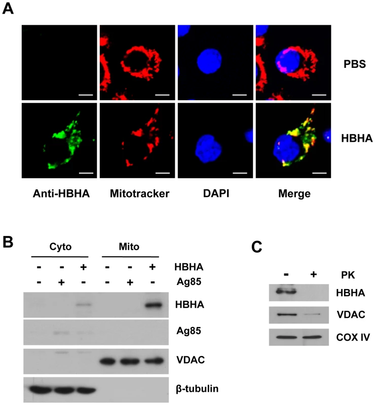 Subcellular localization of HBHA in macrophages.