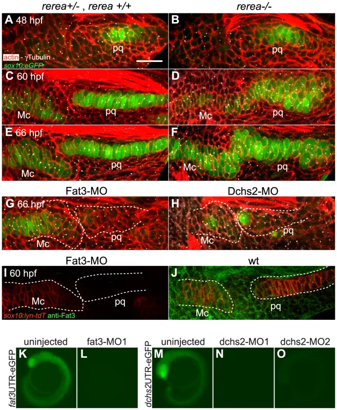 REREa, Fat3 and Dchs2 are required for cartilage stacking and polarity.