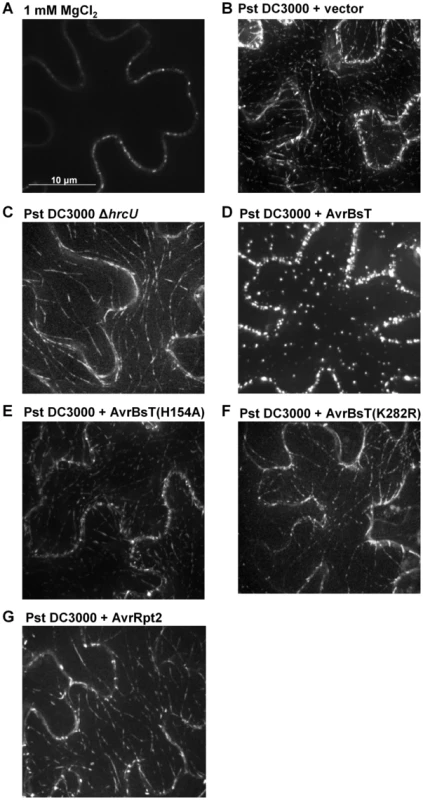 AvrBsT alters GFP-ACIP1's localization in a catalytic-dependent manner.