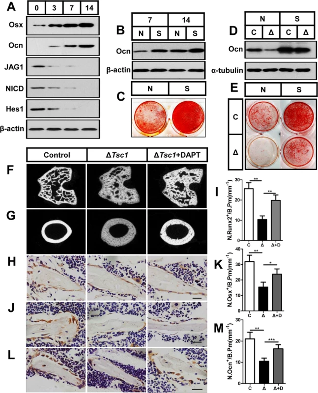 mTORC1 impairs osteoblast differentiation through the Notch pathway upstream of Runx2.