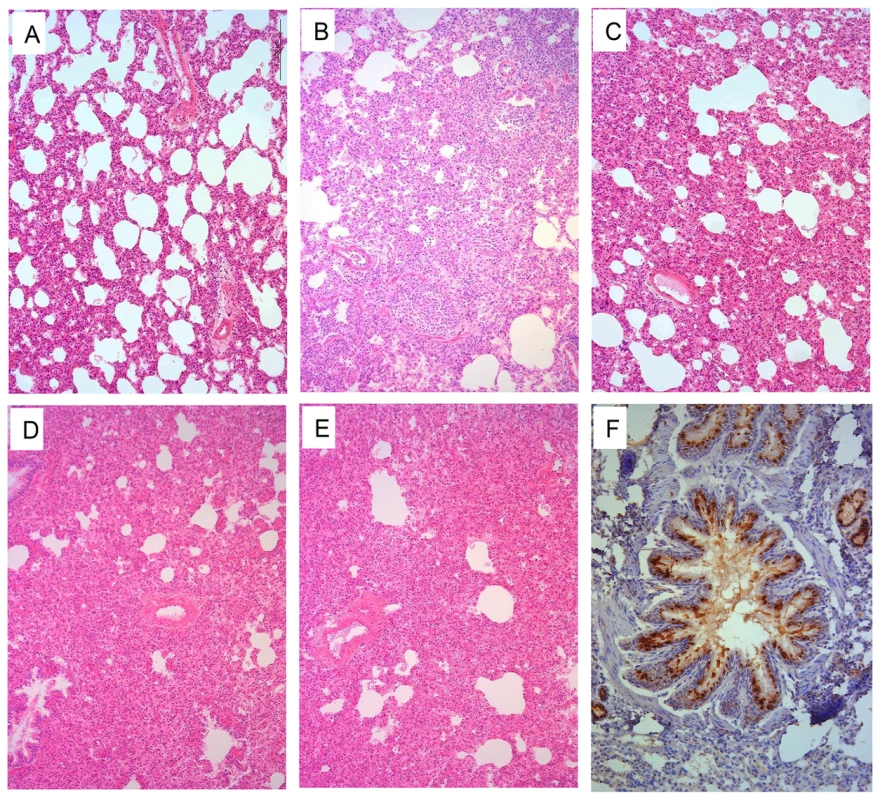 Histological lesions caused by H9N2 viruses in the lungs of ferrets.