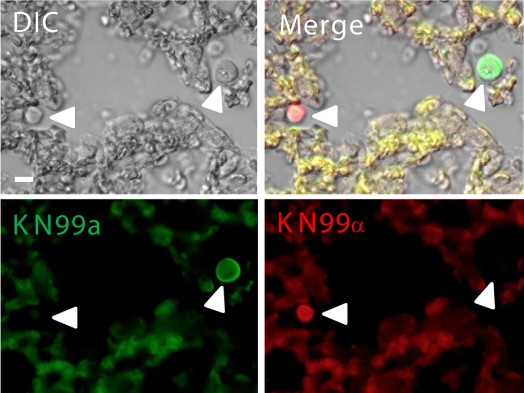 Fluorescently labeled a (green) and α (red) cells in the lungs during coinfection.