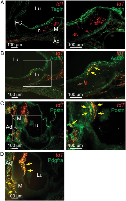 <i>Tcf21</i> lineage traced cells in <i>Ldlr</i><sup><i>-/-</i></sup> lesions give rise to smooth muscle cells in the fibrous cap.