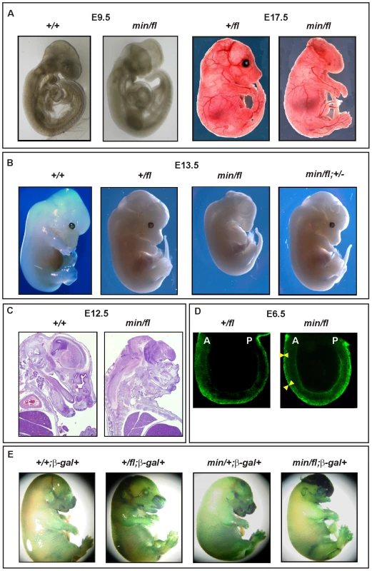 Excessive Wnt/β-catenin signaling results in anterior head defects during embryonic development.
