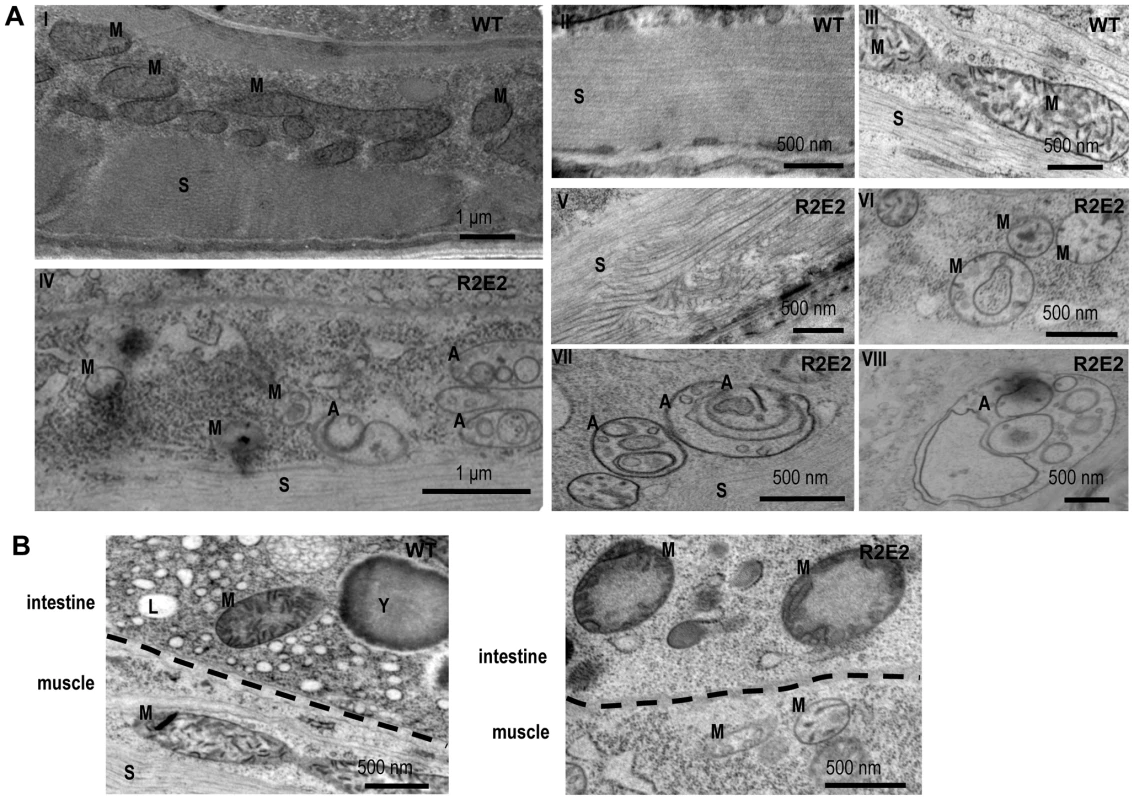 Transmission Electron Microscope (TEM) analysis reveal that mitochondrial defects and induction of autophagy are prominent features of prion domain–induced pathology.