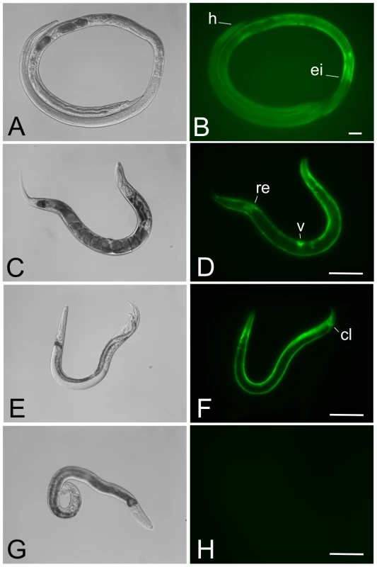 Parasitic and free-living adults from a stable transgenic line of <i>Strongyloides ratti</i> express GFP in the body wall-specific manner expected for the <i>Ss-act-2</i>prom::<i>gfp</i> transcriptional reporter.