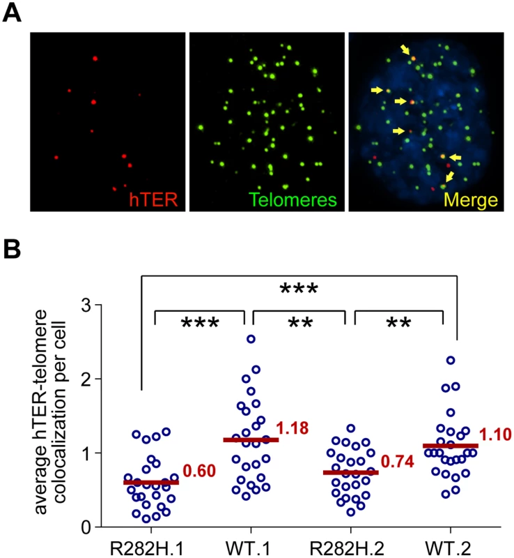 TIN2-R282H mutation reduces colocalization between endogenous telomerase RNA and telomeres.