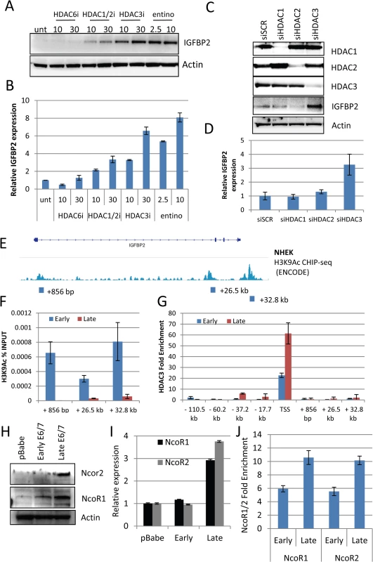 HDAC3 is a critical regulator of IGFBP2 expression.