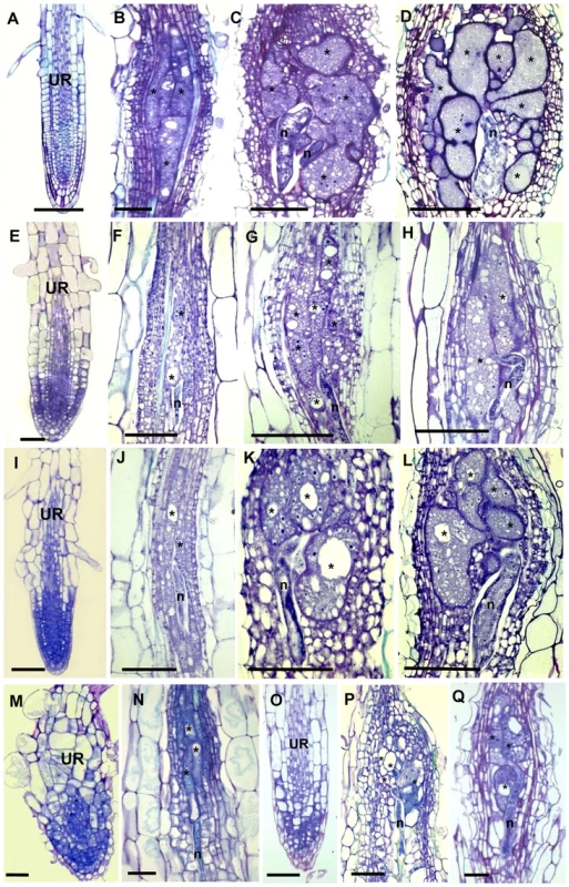 Histological Analysis of Galls and Roots in γ-Tubulin Mutant and Wild-Type <i>Arabidopsis</i> seedlings.