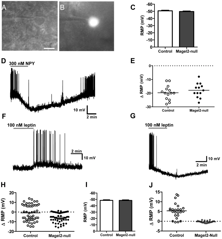 Magel2 is required for the leptin-induced depolarizing response in POMC neurons.