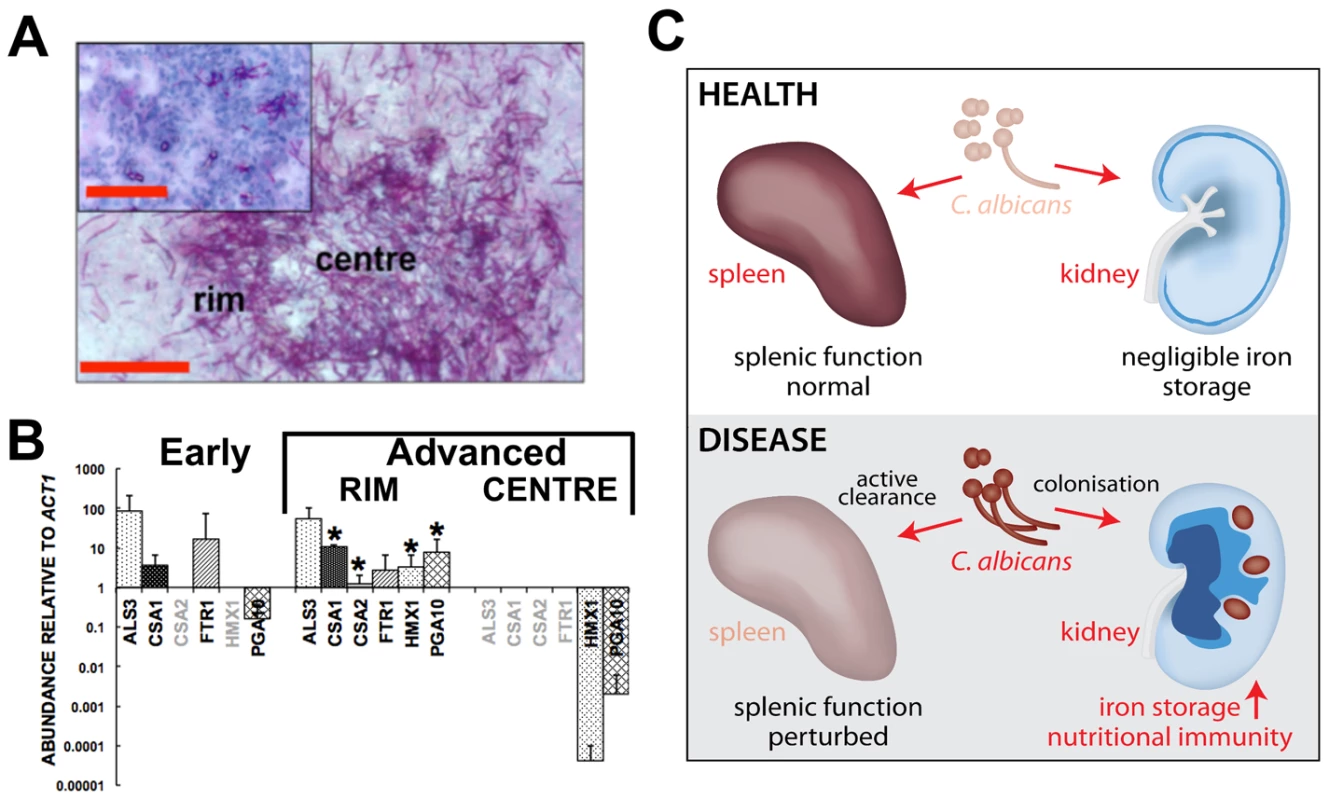 Systemic candidiasis impacts upon iron homeostasis of both the fungus and the host.