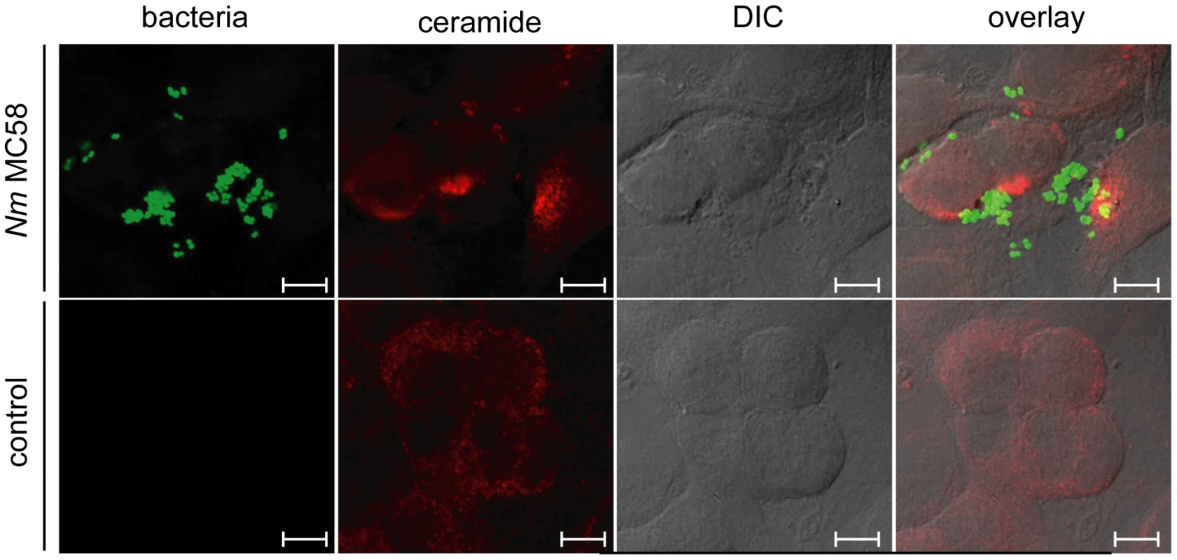 <i>N. meningitidis</i> induces the formation of ceramide-enriched membrane platforms on brain endothelial cells (HBMEC).